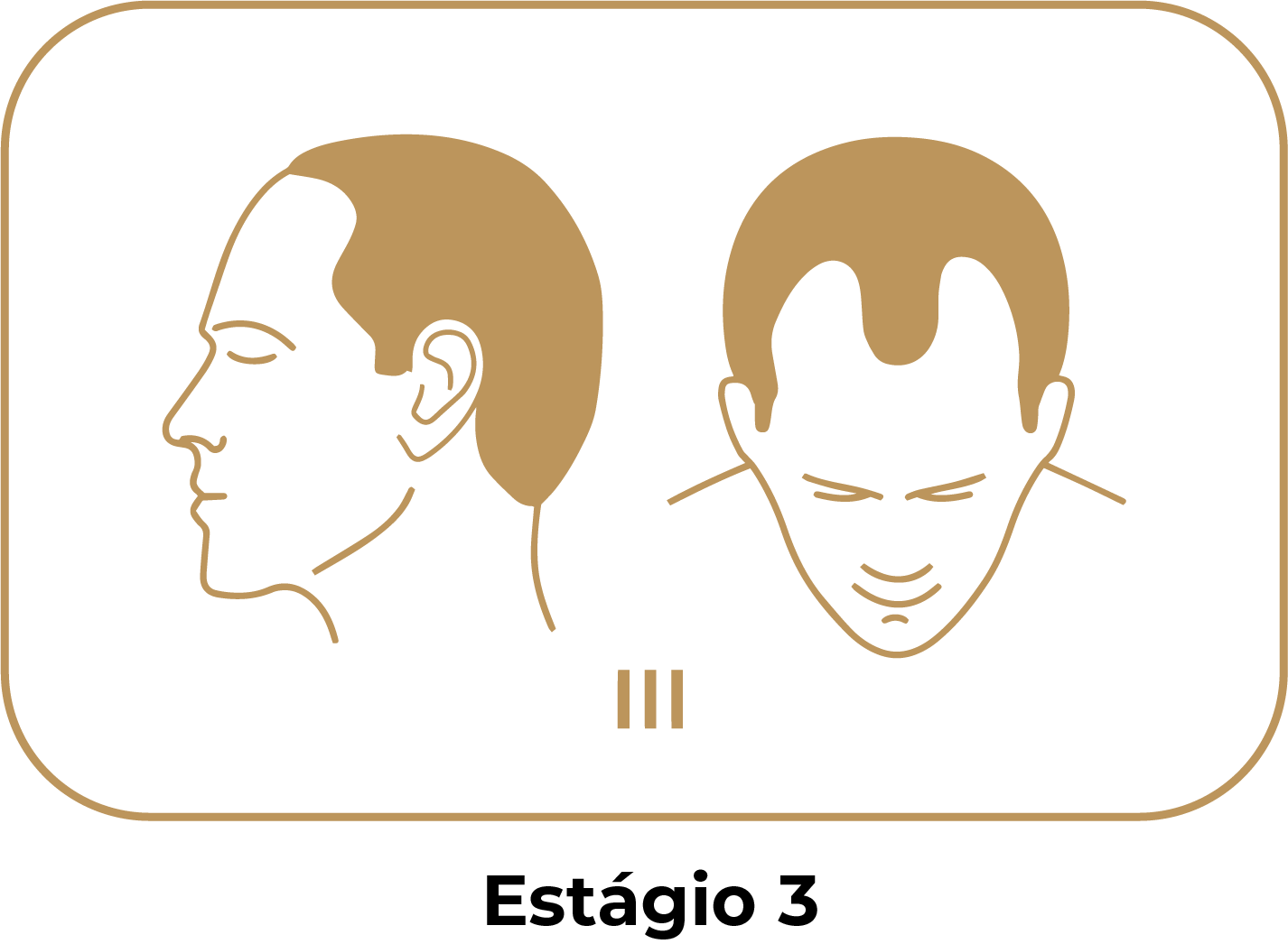 Estágio 3